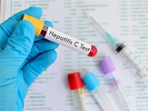 hepatitis c